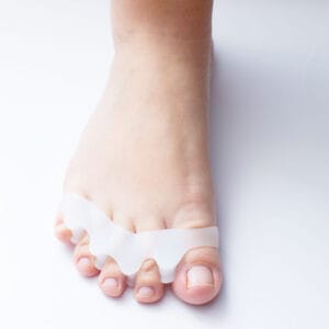 hallux valgus tåseparerare