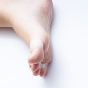 hallux valgus tåseparerare